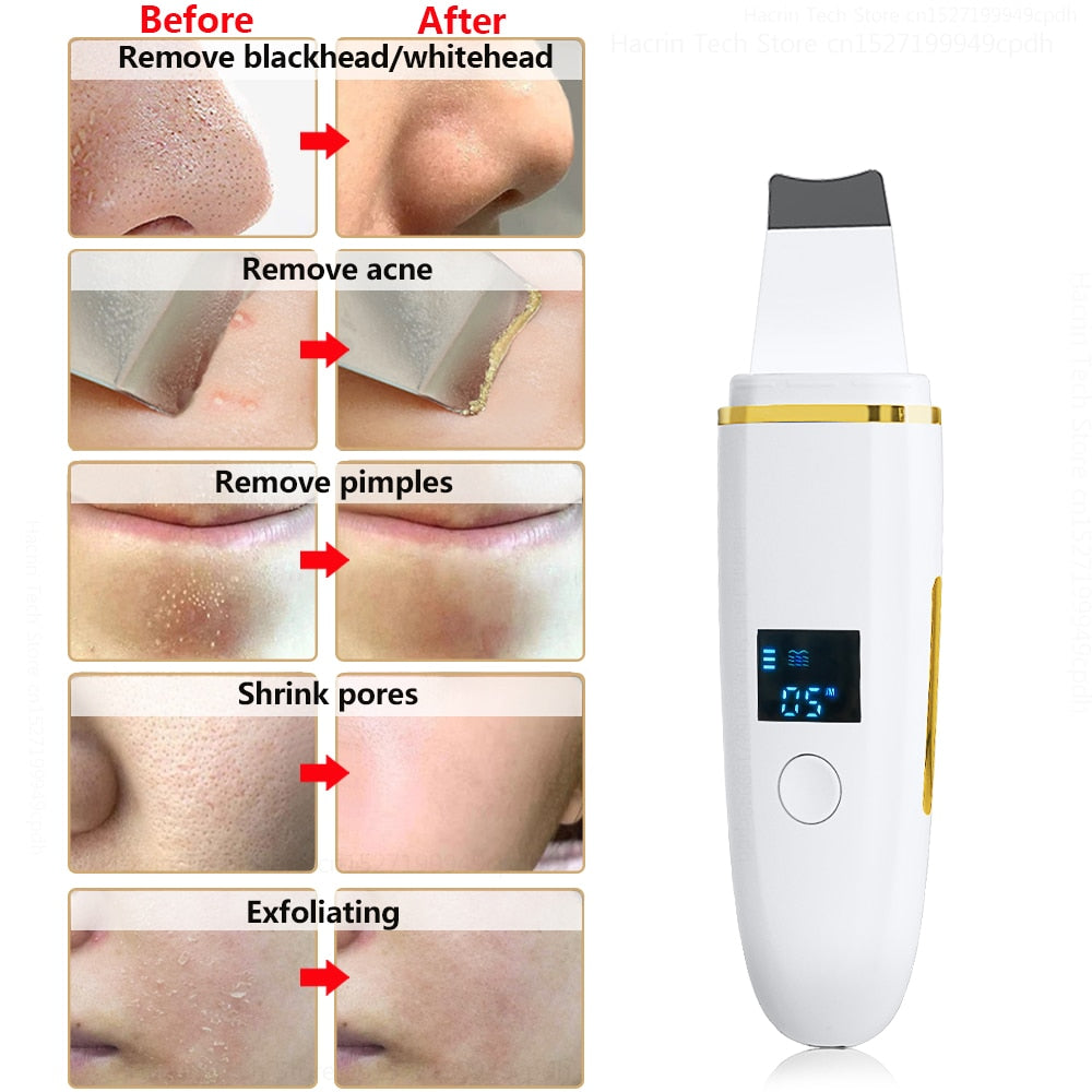 Skin Scrubber Remover