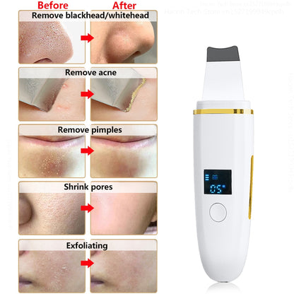 Skin Scrubber Remover